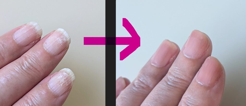 ohoraネイル強化剤 使用前使用後